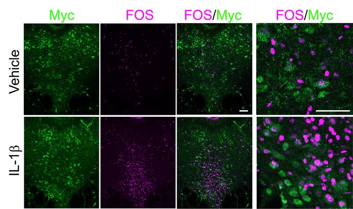 A figure from the paper illustrates that among cells expressing myc (green), a proxy for the IL-1R1 receptor, neural activation is much greater as measured with fos (magenta) when IL-1 beta was administered vs. when a control (vehicle) chemical was.
