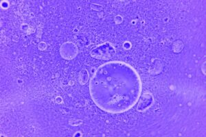 stained cells on a slide