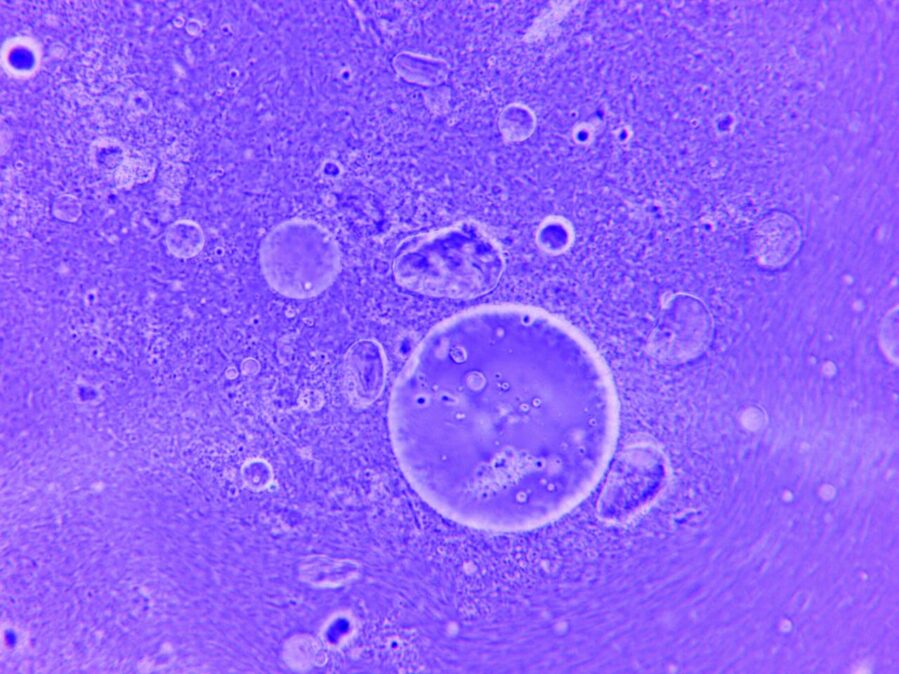 stained cells on a slide