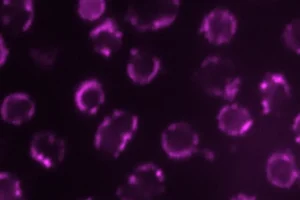 Methane-producing archaea from the species Methanosarcina acetivorans. The microbes are stained with a fluorescent dye that specifically binds to the membranes of archaea.