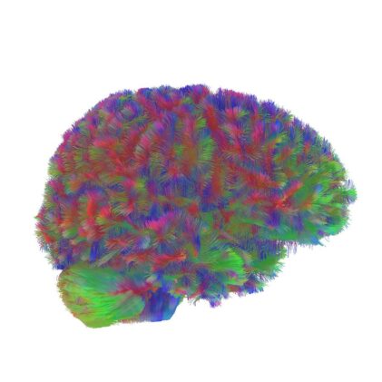 colrized brain