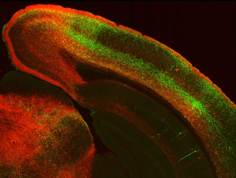 An image from the research shows where neurons from the ACA (red) and ORB (green) regions of the prefrontal cortex innervate the visual cortex.