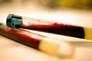 blood tubes for parkinsons