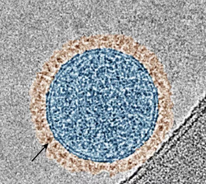 A color-enhanced microscope image showing an exosome (in blue) with PD-1 proteins on its surface (in brown). The black arrow points to the ring of PD-1.