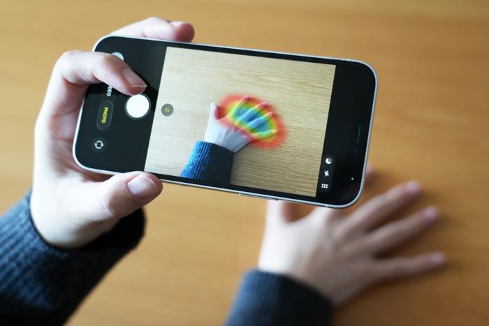 AI Detects Rare Hormone Disorder From Hand Photographs Alone