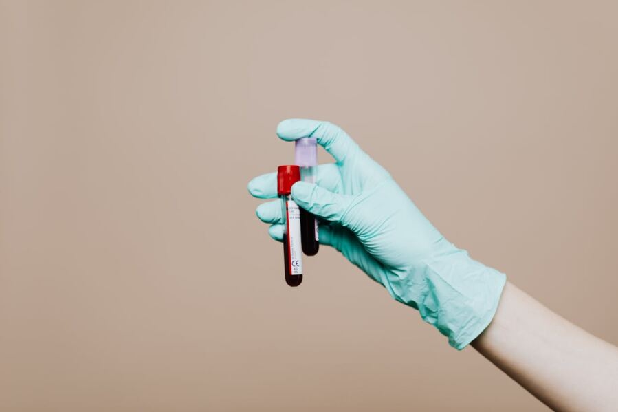 A Blood Test That Reads The Alzheimer's Clock