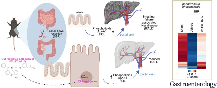 Good Cholesterol in Your Gut Could Protect the Liver After Bowel Surgery