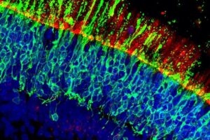 Human retinal organoid. Photoreceptors are labelled in green and the light sensing compartment is labelled in red. Organoid cell nuclei are labelled in blue.