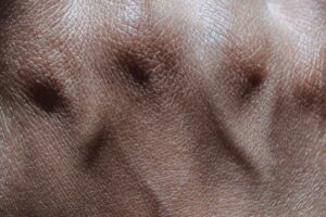 closeup of human skin
