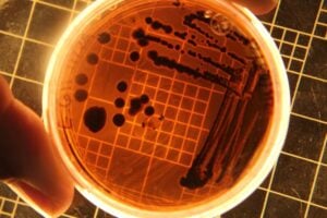 petri dish
