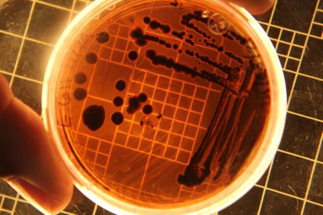 petri dish