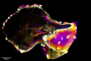 A neurobot stained to highlight multiciliated cells – with small tufts of hairlike cilia around the periphery of the bot – and the neuronal extensions of dendrites and axons seen in the center.