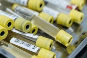 urine test vials