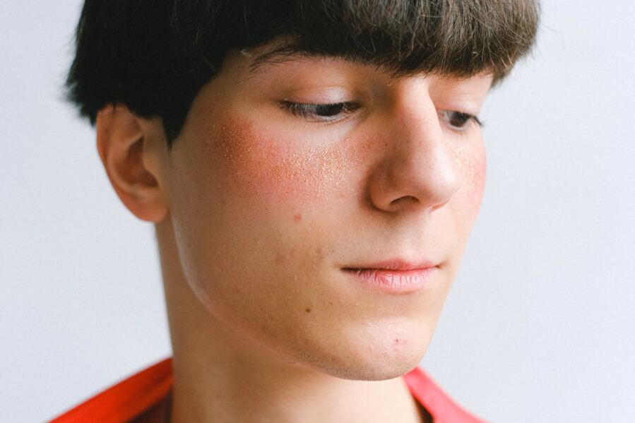 Sensitive Skin Syndrome and Rosacea Are Not the Same Condition, and the Difference Is Written in Your Proteins