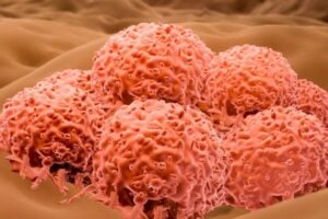 Cancer cells