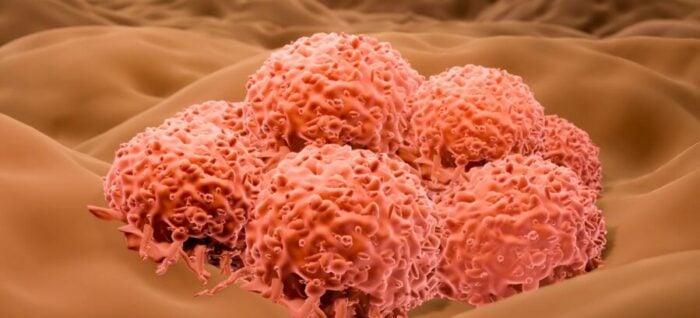 Cancer cells