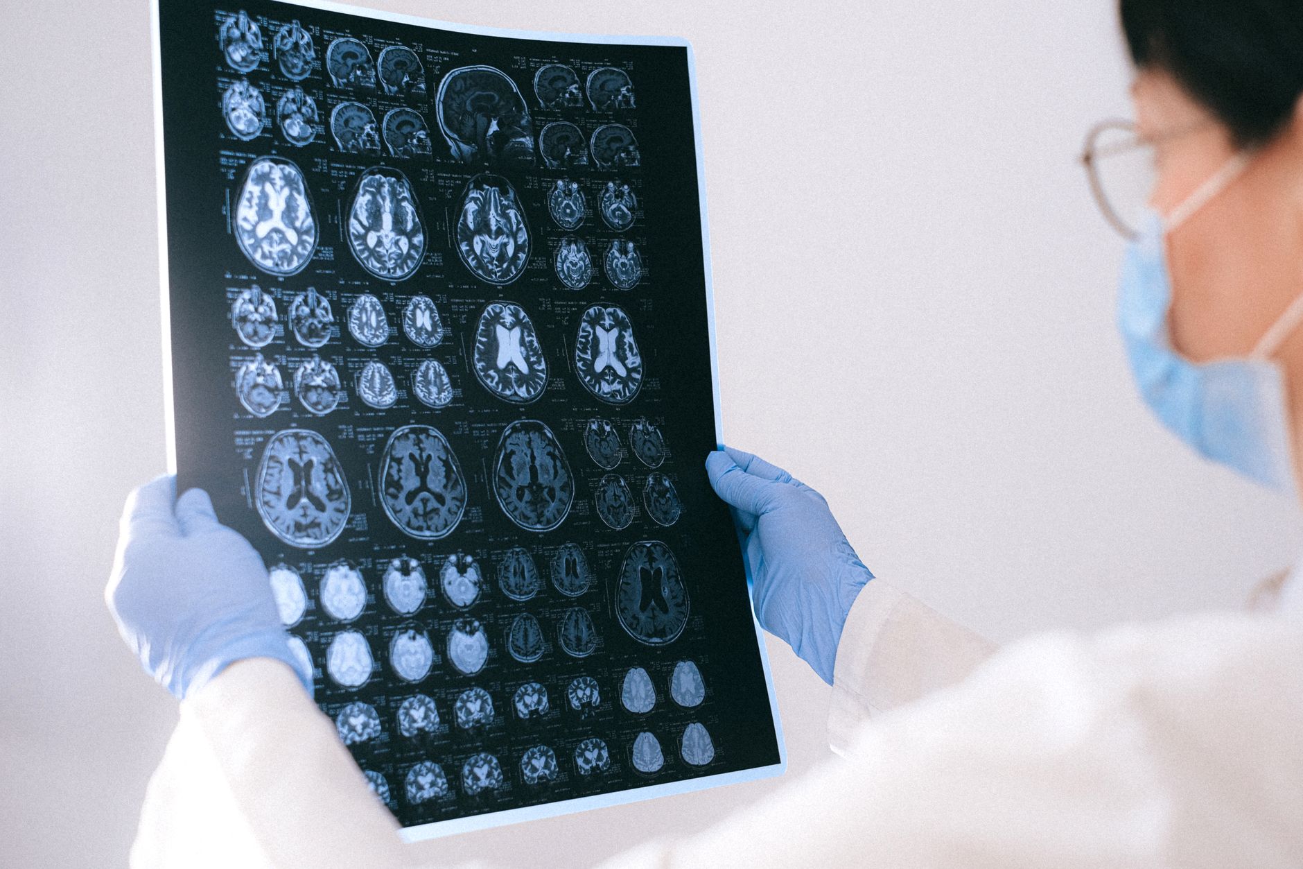 Medical professional holding a sheet of MRI brain scans