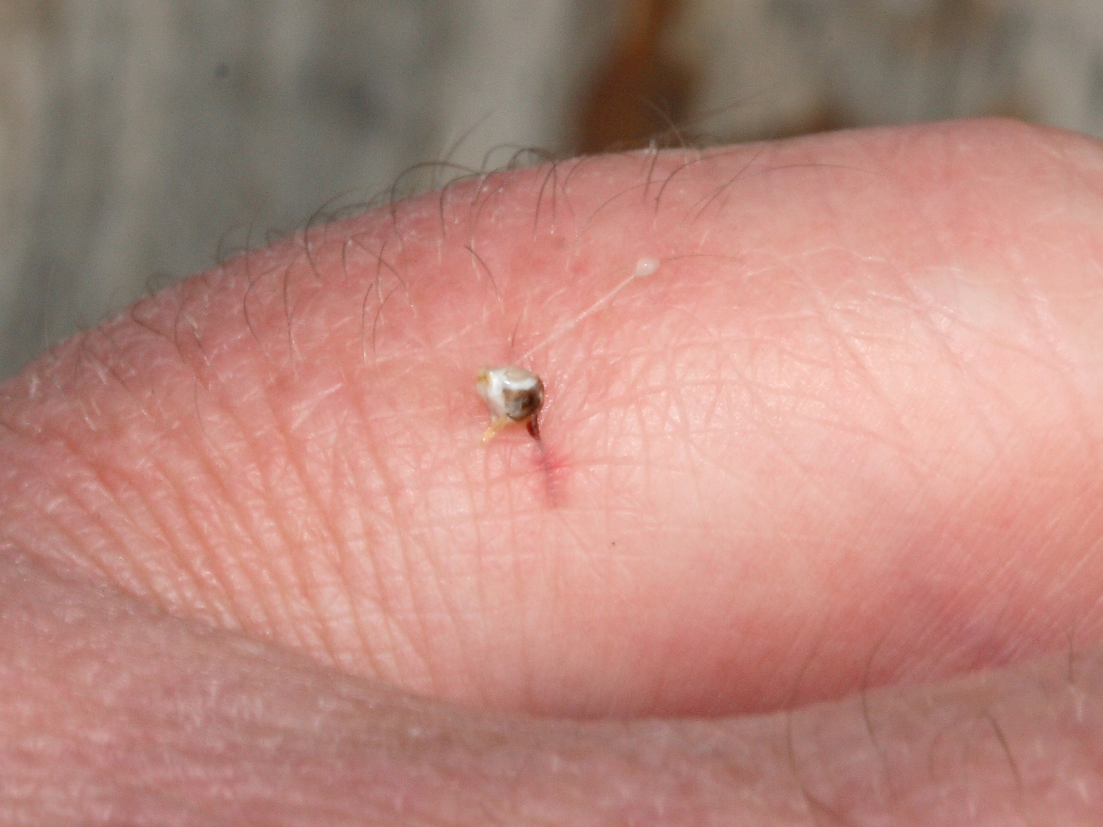 Close-up of a honey bee stinger embedded in the skin of a finger, with the pale, torn-off end of the sting apparatus still attached above the puncture.