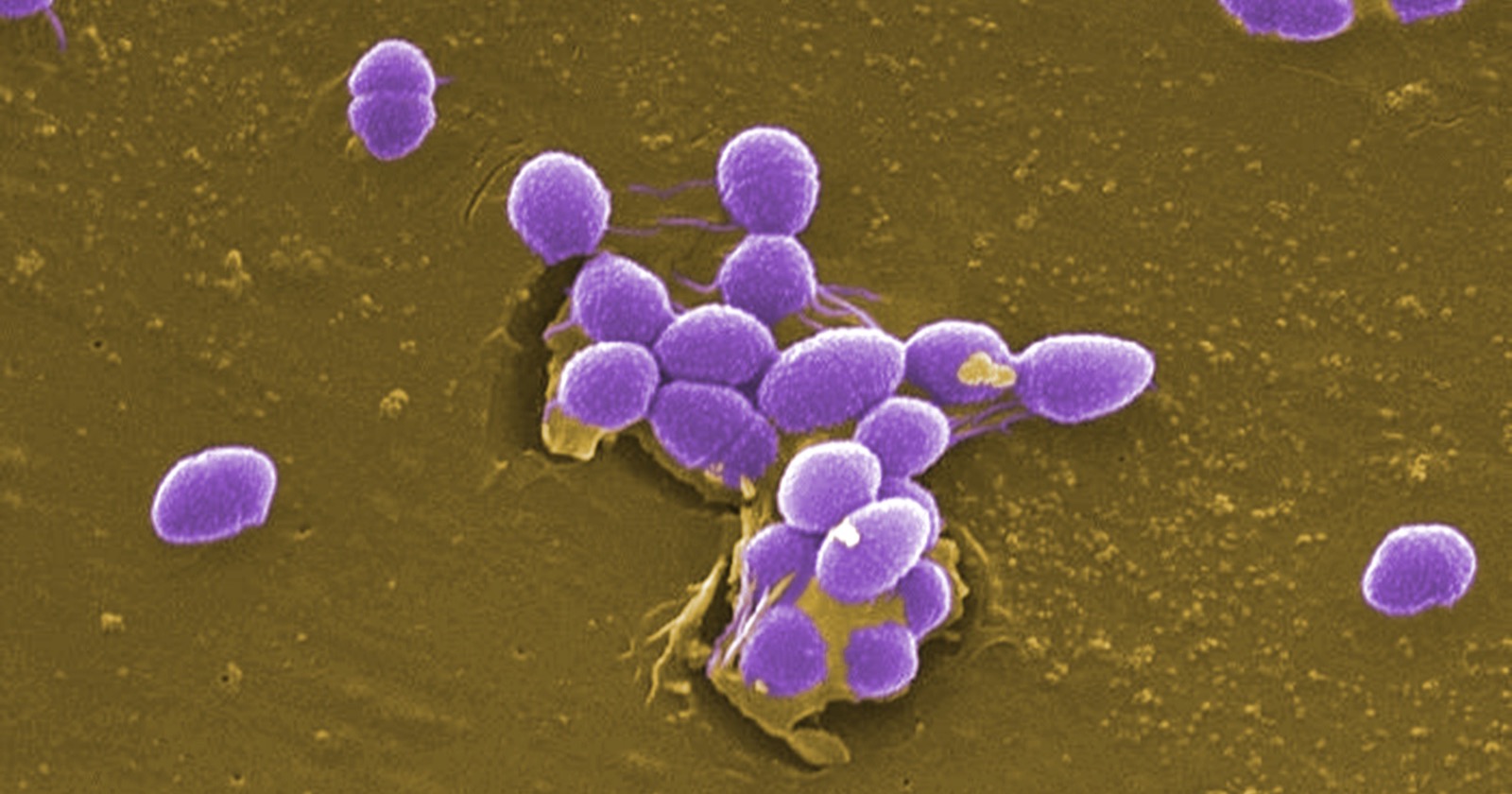 Purple, colorized Enterococcus faecalis bacteria clustered on a brown surface under a scanning electron microscope