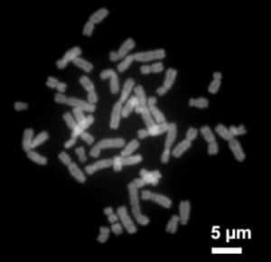 A close up of some human chromosomes (Photo Credit: Steffen Dietzel).